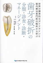 破折歯への対応